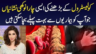 Cholesterol Level ko Kam Karne Ka Asan Tarika  How to Control Cholesterol Level  Dr Sahar Chawla [upl. by Yerhcaz]