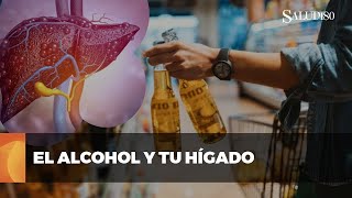 ✅ ¿Cómo el consumo de ALCOHOL afecta la salud de tu hígado  Salud180 🌿 [upl. by Bethesde579]