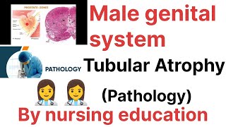 PathologyMale genital system Testicular atrophynursing education bscnursing gnmpost Bsc N [upl. by Davidde]