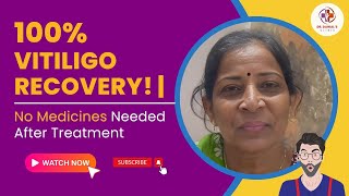 100 Vitiligo Recovery  No Medicines Needed After Treatment  Dr Danial’s Clinic Ankleshwar [upl. by Lairbag]