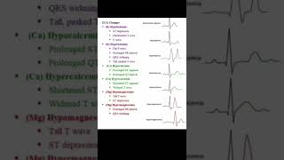 ECG Reading  ECG Changes  ECG Report Understand very easily  norcet2023 hospitalstaff [upl. by Mathias928]