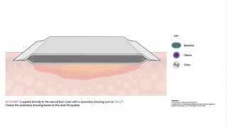 ACTISORBֲ כיצד פועלת חבישת אקטיסורב [upl. by Assirolc]