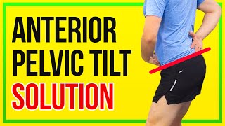 How to Fix Anterior Pelvic Tilt 4 KEY EXERCISES [upl. by Hallette145]