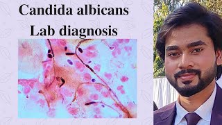 Candida  Candida albicans  Candidiasis  Lab Diagnosis By Abhishek sir [upl. by Cosimo]