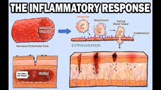 THE INFLAMMATORY RESPONSE [upl. by Chelton579]