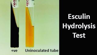 Esculin Hydrolysis Test A biochemical test for Esculinase Enzyme Producing Bacteria [upl. by Sybyl]