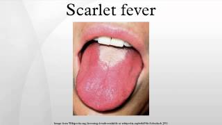 Scarlet fever [upl. by Lebasy]