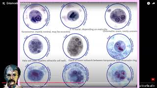 Diagnostic Parasitology Entamoeba histolyticaCourse [upl. by Luedtke]