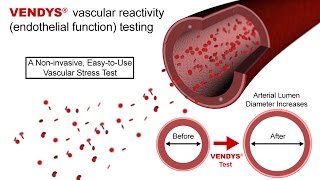 VENDYS  Endothelial Function Measurement Explained [upl. by Mona]