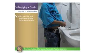 Pediatric ColostomyIleostomy Emptying a Pouch [upl. by Asiralc]