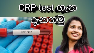 CRP test කියන්නෙ මොකක්ද [upl. by Eytak]