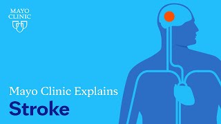 Mayo Clinic Explains Strokes [upl. by Floris]