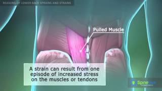 Lower Back Sprain and Strain Reasons [upl. by Aisiram284]