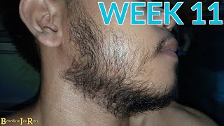 FILIPINO BEARD GROWTH USING MINOXIDIL WEEK 11 RESULTS [upl. by Atinreb]