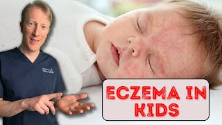 How to treat Eczema in Babies amp Children Dermatology Doctor explains [upl. by Raffaj]