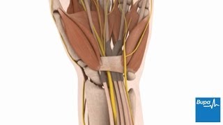 How open carpal tunnel surgery is carried out  Bupa Health [upl. by Sherr]