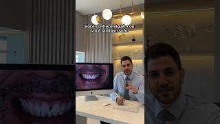 Diastema solucionado com lentes [upl. by Monteria]