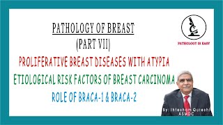 Proliferative Breast Diseases with Atypia Etiological Risk Factor of Breast CA Role BRACA1 amp BRACA2 [upl. by Weintrob153]