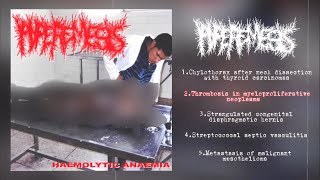 Hyperemesis  Haemolytic Anaemia Split with PxCxSx 2013 Goregrind [upl. by Swetlana]