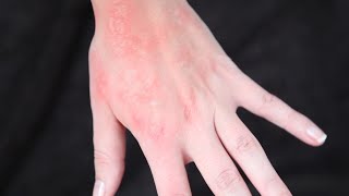 Rash  SFX makeup Tutorial [upl. by Tertia67]