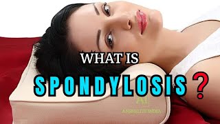 What is Spondylosis ।। How it Troubles You ।। Remedies [upl. by Yug676]