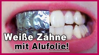 ▶︎ Zähne aufhellen mit Alufolie  es funktioniert [upl. by Prosser986]