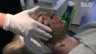 Beau Monde test de Neoderma Biopeeling [upl. by Craig539]