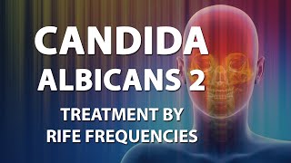 Candida Albicans 2 Candidiasis  Rife Frequencies  Energy amp Quantum Medicine  Bioresonance [upl. by Xella571]