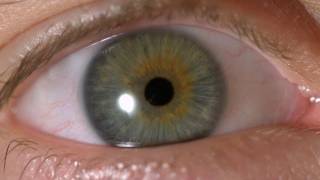 My Iris Wobbles  Eye In Slow Motion [upl. by Notnef]