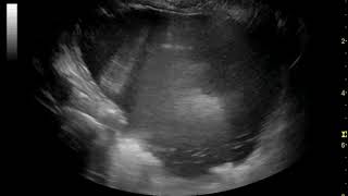 Ultrasonography of gastric ileus in a dog with putative seasonal canine illness [upl. by Ayvid]