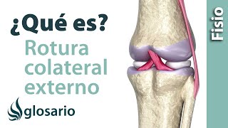 ROTURA DEL LIGAMENTO COLATERAL EXTERNO DE LA RODILLA  ¿Qué es [upl. by Burtis]