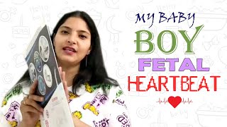 My Baby Boy Heartbeat in Pregnancy लड़का होने पर यह Heartbeat थी मेरी baby boy [upl. by Lehman]