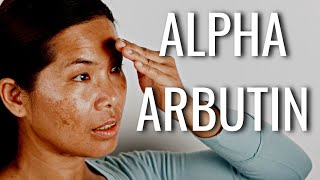 Put Alpha Arbutin On Your Dark Spots amp SEE What Happens [upl. by Eatnod]