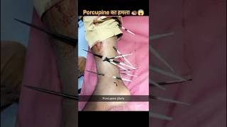 Porcupine का हमला 🦔😱😱⁉️fact facts factsinhindi knowledge ytshorts [upl. by Lahpos442]