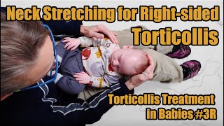 3R Neck Stretching for Rightsided Torticollis Torticollis Treatment in Babies [upl. by Fatsug769]