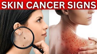 Skin Cancer Signs and Symptoms [upl. by Frannie300]