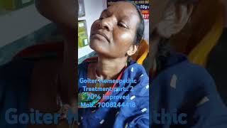 Goitre Homeopathic Treatment Part 2 Improved 70 [upl. by Yeltihw]