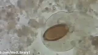 Trichuris trichiura تريكيرا تركيرا [upl. by Kaycee]