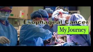 Esophageal Cancer My Journey 9 [upl. by Rolo]