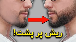 ریش پرپشت  چگونه ریش پرپشت داشته باشیم؟ هفت ترفند فوری [upl. by Nnayhs408]