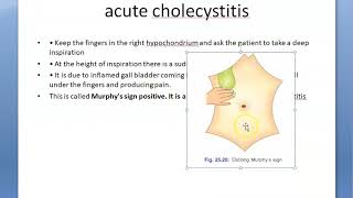 Surgery Murphy sign Triad difference [upl. by Wain]