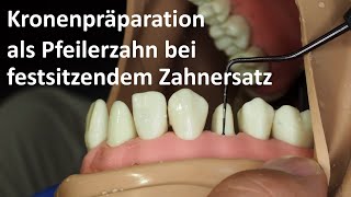 Kronenpräparation II Kronenpräparation als Pfeilerzahn bei festsitzendem Zahnersatz 4K [upl. by Yeniffit376]