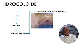 HIDROCOLOIDE Parte 2 [upl. by Kleeman]