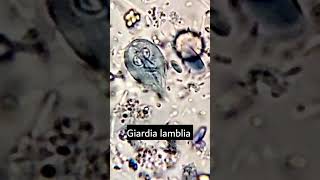 Giardia lambliaGiardiasis parasiteparasite under microscope microscopy parasitology [upl. by Orpah673]