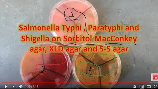 Salmonella enerica serotype Typhi amp Paratyphi growth on various media [upl. by Furgeson]