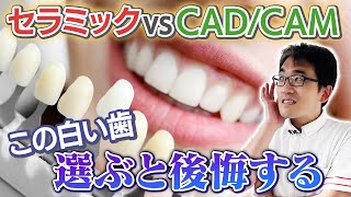 【セラミック治療】何万もかけた憧れの白い歯で後悔⁉︎ 知ってほしいセラミックのメリット・デメリット｜金田歯科医院 [upl. by Kimberlyn]