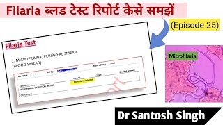 How To Read Filaria Blood Test Report Dr Santosh Singh Episode 25 [upl. by Dahc964]