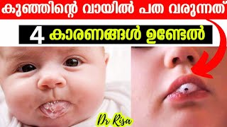 Baby Care Tips Malayalam Foamy Saliva in Babies  കുഞ്ഞിന്റെ വായിൽ പത വരുന്നത് [upl. by Salohcin687]