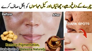 Face Pack For Pigmentation Dark Spots Acne Marks amp Melasma Removal Pigmentation Treatment At Home [upl. by Nreval]