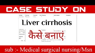 Case study on liver cirrhosis  msn case study medical surgical nursing Dhyeya7132 [upl. by Sedgewick354]